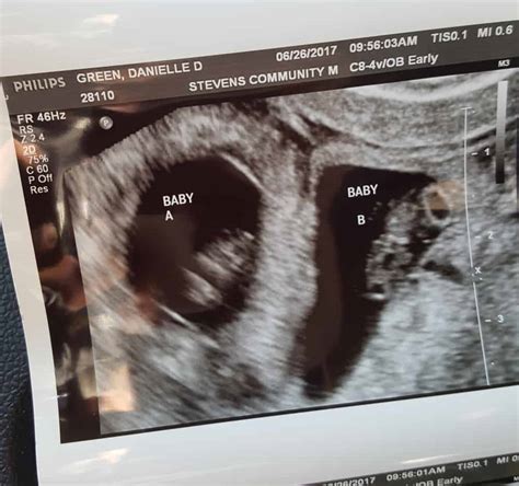 dating ultrasound two weeks behind